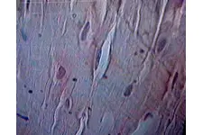 Fibröz Kıkırdak Özellikleri